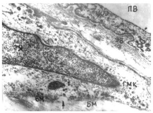 Цитоплазматический отросток эндотелоцита с признаками отека 